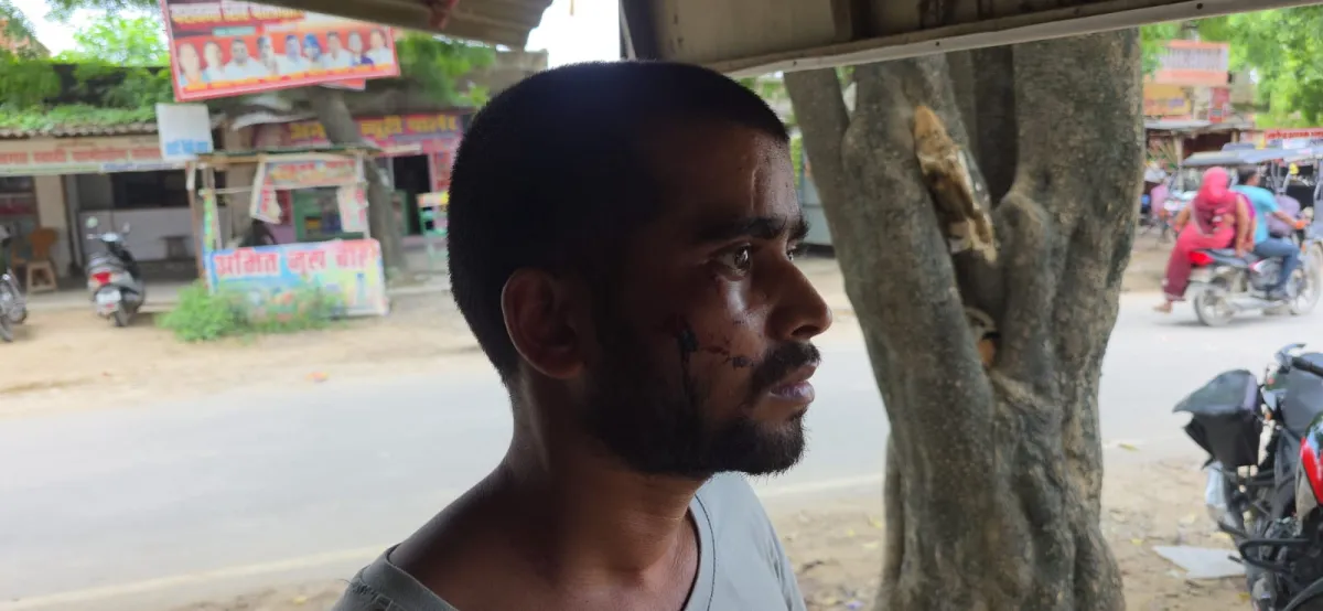 Photo: A girl returning from defecation was molested, brother was beaten when he protested, and bitten on t...